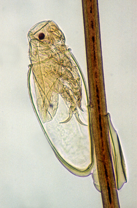 Bild: Nisse bzw. Larve der Kopflaus (© Ronald Schmäschke – Fotolia.com)